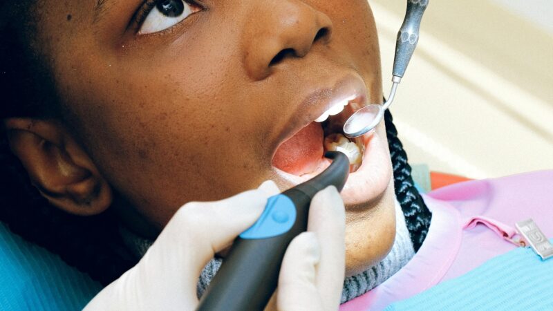 CROWNS, FILLINGS...